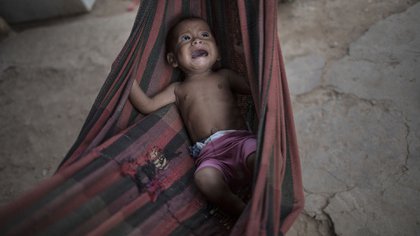 Osmery Vargas, que está desnutrida, llora en una hamaca mientras ella y su hermana de 7 años, Yasmery Vargas, esperan a su madre en Maracaibo, Venezuela (AP Photo/Rodrigo Abd)