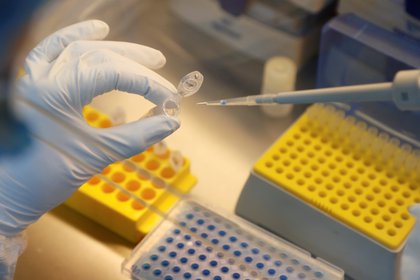 Un científico diluye muestras durante la investigación y el desarrollo de una vacuna contra la enfermedad por coronavirus (COVID-19) en un laboratorio de la compañía de biotecnología BIOCAD en San Petersburgo, Rusia, 11 de junio de 2020. (REUTERS / Anton Vaganov)