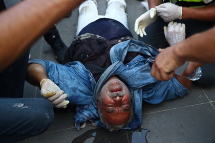 Un manifestante herido (REUTERS/Hannah McKay)