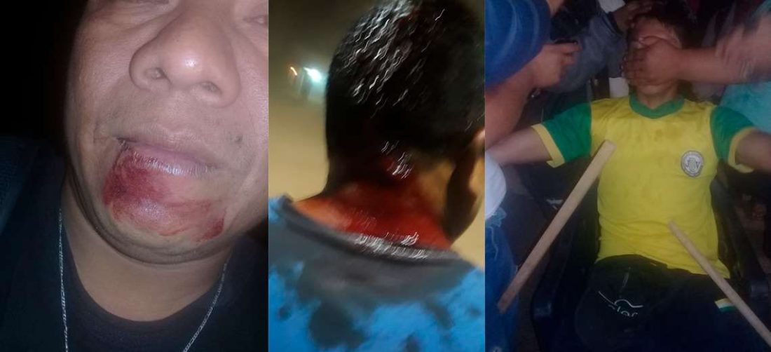 Heridos en enfrentamiento en Ascensión