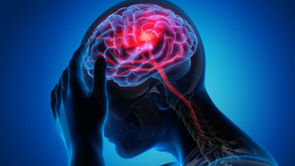Un ataque cerebral se produce cuando una parte del cerebro deja de recibir sangre por la oclusión de una arteria