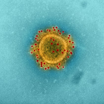 El coronavirus bajo el microscopio (NIAID)