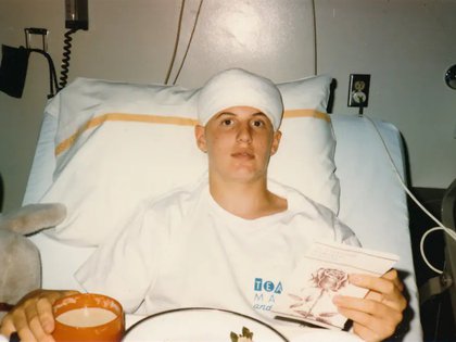 Jeff Henigson en agosto de 1986 a los 15 años después de una cirugía por un tumor cerebral. (Robert Henigson)