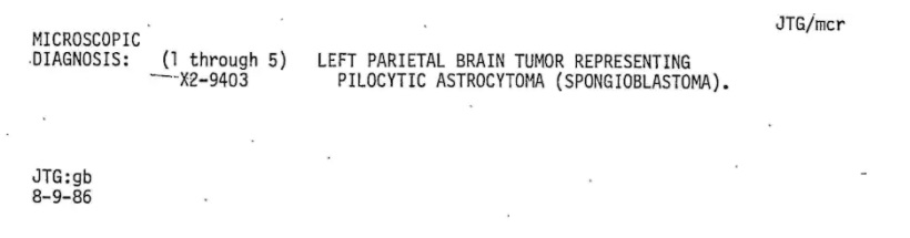 El informe médico de Jeff Henigson, fechado el 9 de agosto de 1986, muestra que su diagnóstico era un astrocitoma pilocítico, un tumor benigno. (Cortesía de Jeff Henigson)