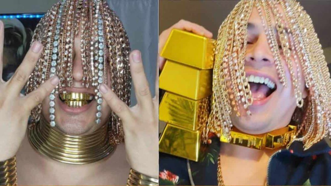 Rapero se implantó cadenas de oro en la cabeza y asegura ser 'semidiós'
