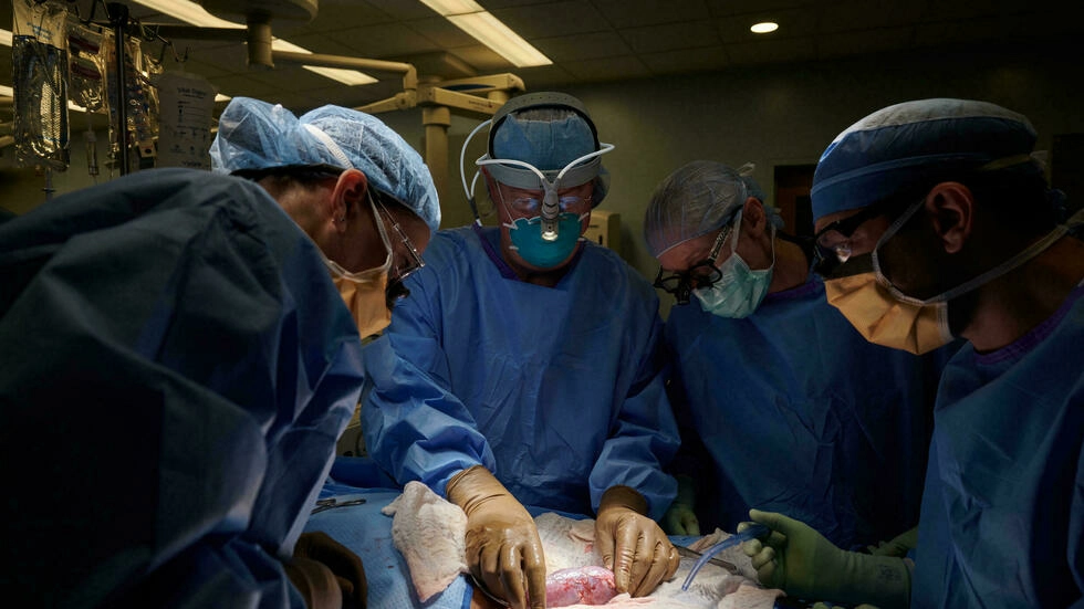 Un equipo de cirujanos del NYU Langone Hospital examina un riñón de cerdo trasplantado a un humano el 25 de septiembre de 2021