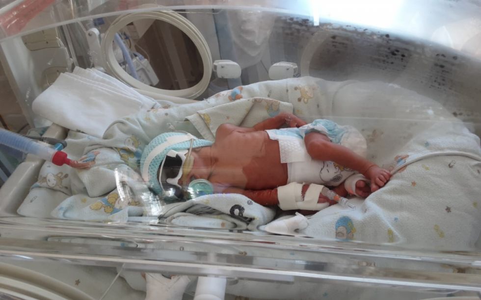 Nacen trillizas en Bermejo, llegaron a Tarija por falta de incubadoras