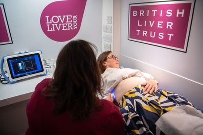 Unidad móvil de escaneo hepático del British Liver Trust en el Congreso Internacional del Hígado, celebrado en junio en Londres.