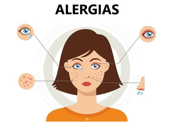 Antes de hablar de los síntomas de alergia es conveniente saber qué es y a quién afecta. - Noticias y Novedades