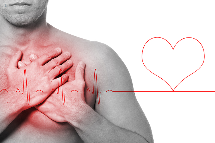 Insuficiencia Cardíaca : qué es, síntomas y tratamiento | Top Doctors