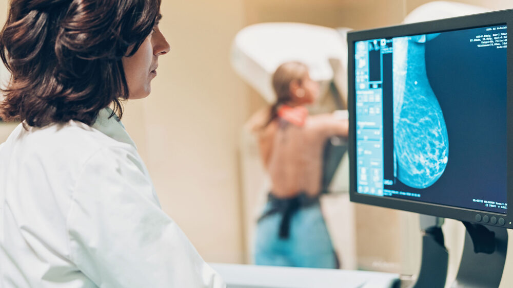 Generalmente el cáncer de mama se diagnostica con la ayuda de una mamografía. En Argentina se desarrolla una biopsia líquida a partir de una muestra de sangre para cáncer de mama. Tiene una sensibilidad del 92% para detectarlo/Archivo