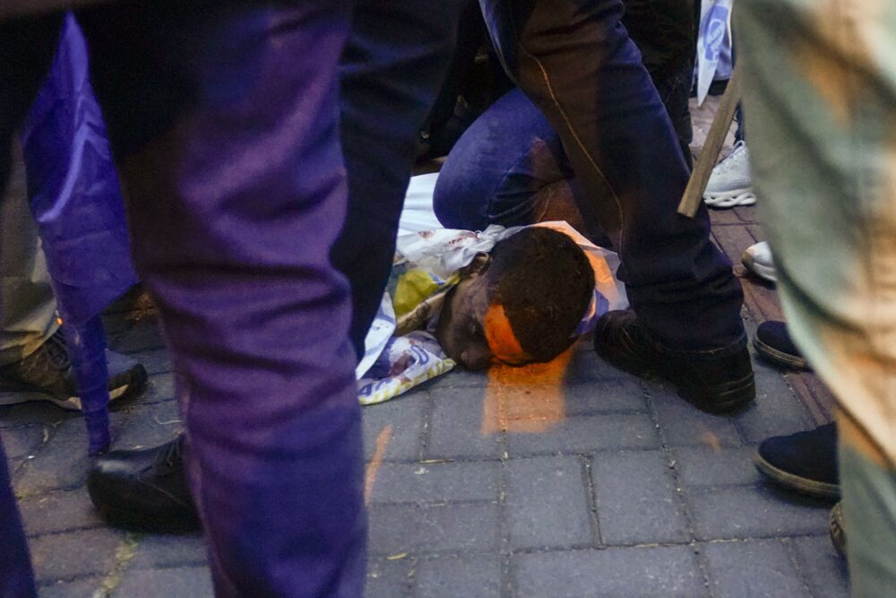 El gatillero recibió impactos de bala y golpes. Murió el mismo día. (AP Foto/Juan Diego Montenegro)