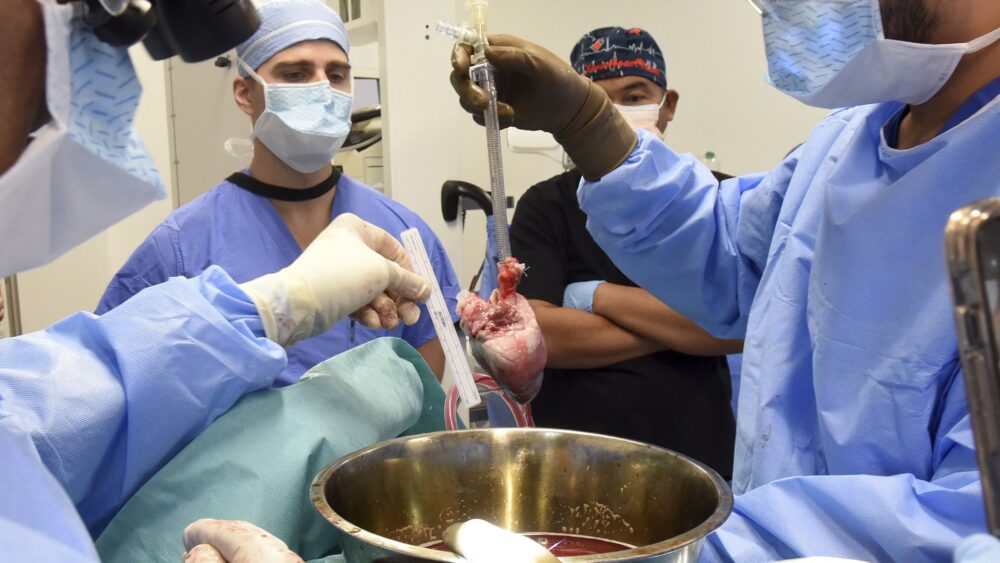 Los cirujanos se preparan para un trasplante de corazón de cerdo a Lawrence Faucette en el hospital de la facultad en Baltimore, Maryland, en septiembre de 2023 (AP)