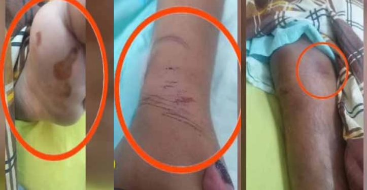 Militar golpeado y torturado en una comisaría está en la UCI