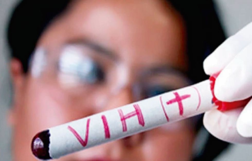 Tarija: El 60% de las personas con VIH son menores de 19 años
