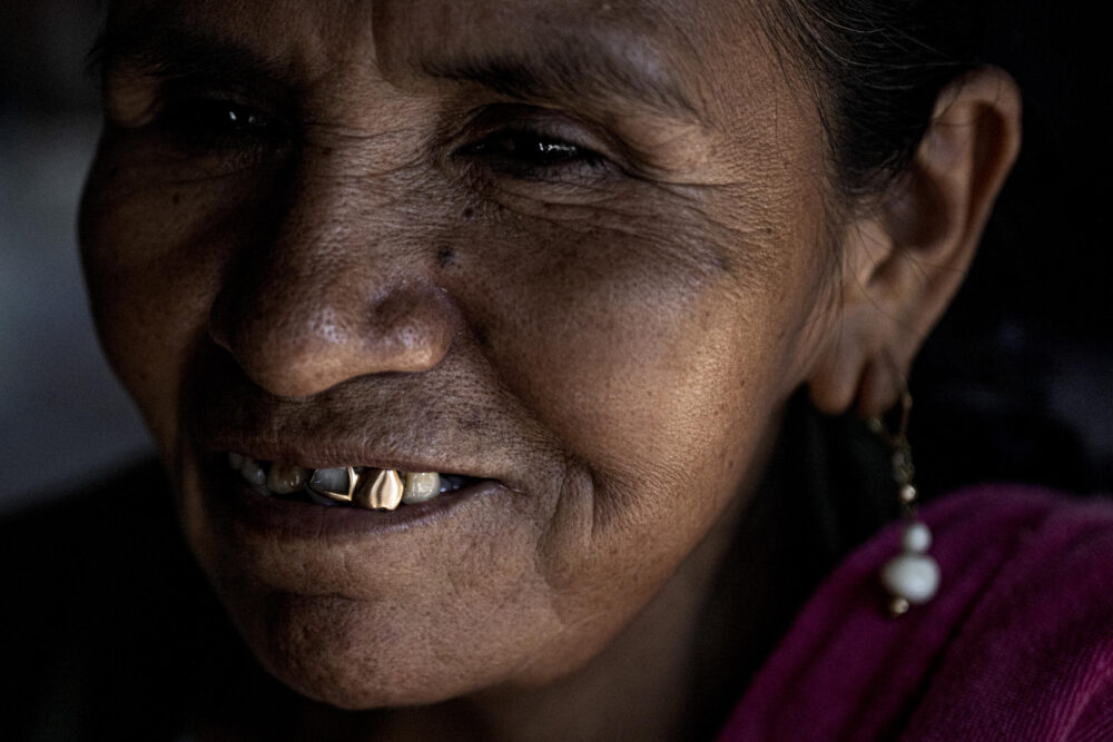 Una mujer sonríe mientras dice que tiene seis gramos de oro en los dientes, en el departamento de Madre de Dios, en la región amazónica del sureste de Perú, el 31 de mayo de 2024