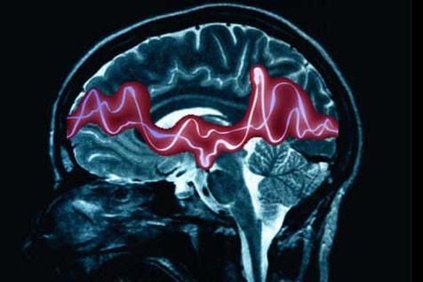 Enfermedad de Alzheimer de aparición temprana autosómica dominante – FEMEXER