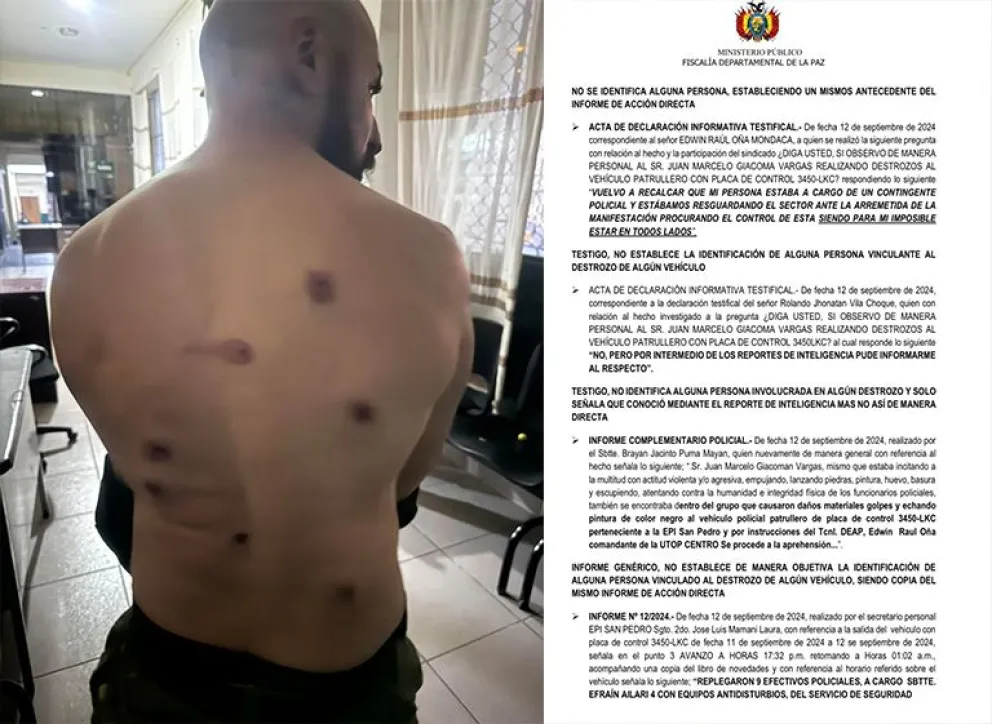 El activista por los derechos de los animales, Juan Giacoman, fue herido con 8 balines de goma. Los Policías no lo identificaron como autor de ningún delito. Foto: Ricardo Rodríguez.