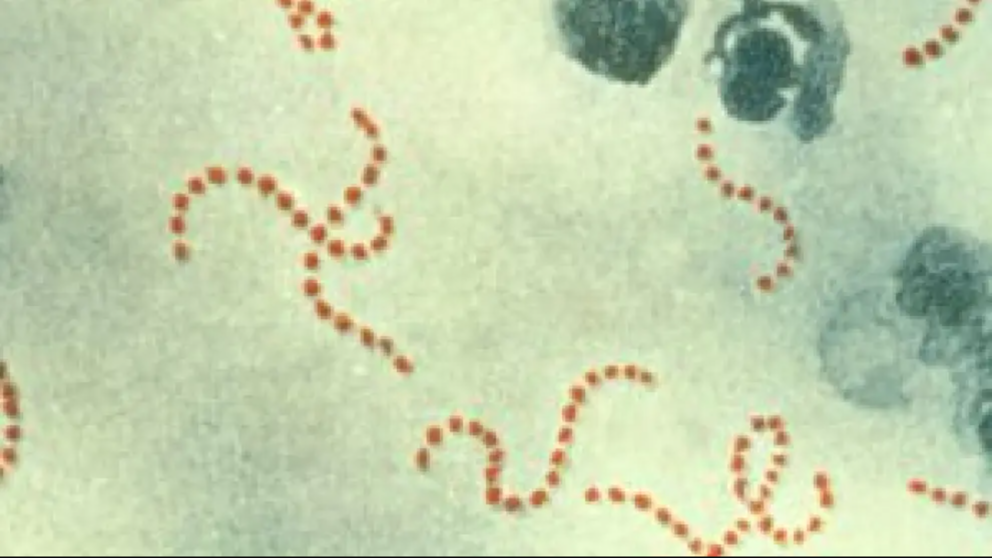 Representación gráfica de la bacteria Streptococcus Pyoges./ 20MINUTOS.ES