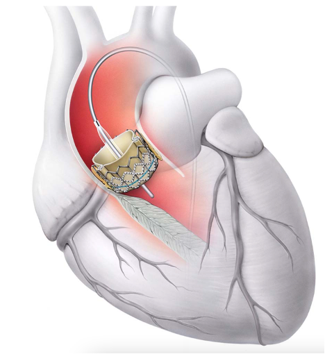 Clínica Cardiovascular