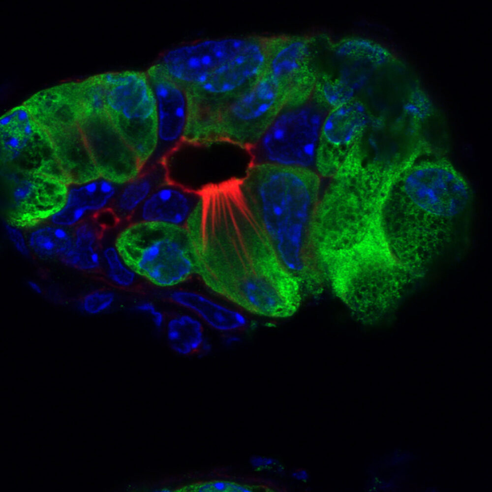 Se descubre que misteriosas células de penacho desempeñan un papel en la pancreatitis - Salk Institute for Biological Studies