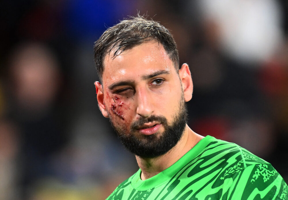 Recibió una patada en el rostro y tuvo que ser reemplazado: la impactante lesión que sufrió Gianluigi Donnarumma en el PSG - Infobae