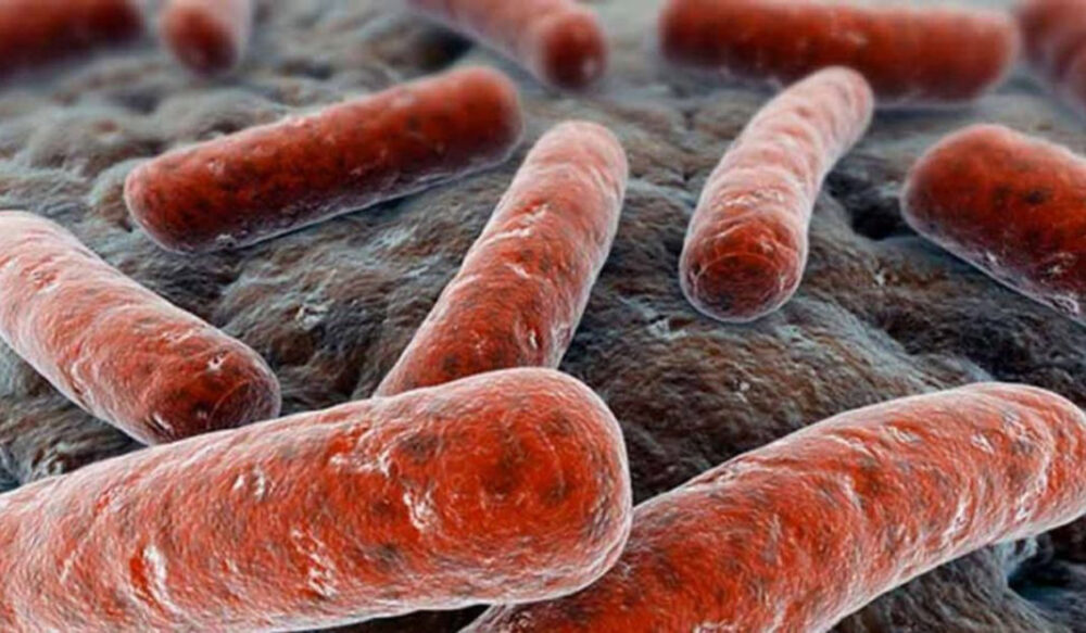 Infecciones múltiples, comunes en tuberculosis multirresistente, según CSIC