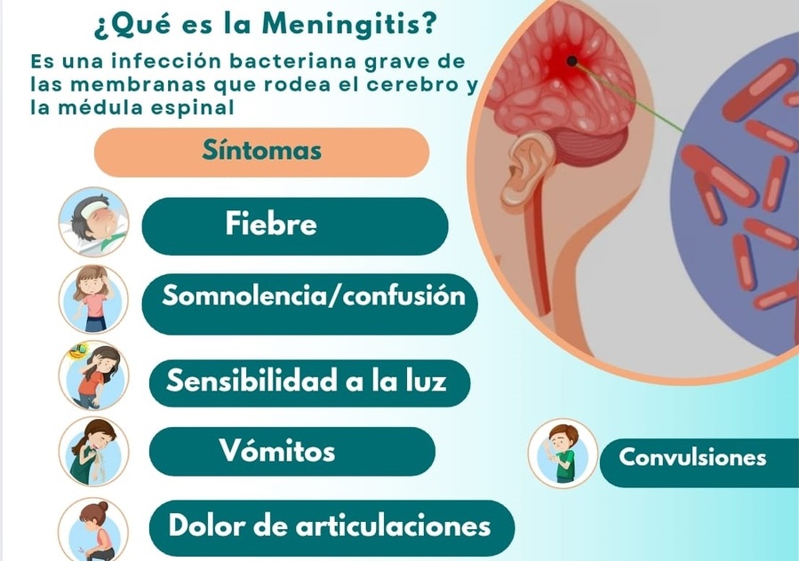 Sedes Cochabamba reporta dos casos sospechosos de meningitis