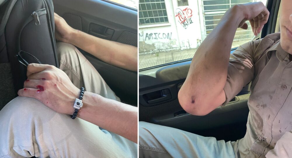 Funcionario agredido en el Concejo 