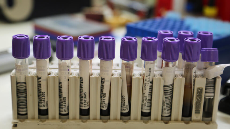 Unas muestras de sangre infectadas con covid-19, dengue, malaria, chikunguya y leptospirosis, fotografiadas en el laboratorio de un hospital en Iquitos, en la Amazonia peruana, el 22 de mayo de 2020