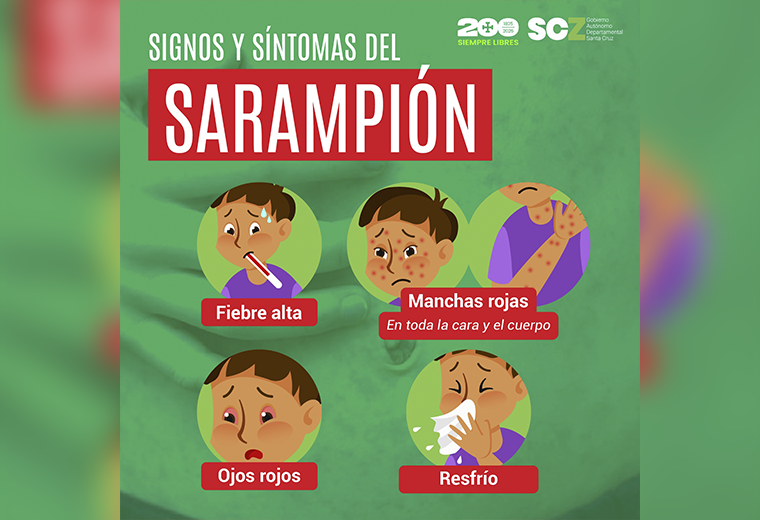 Síntomas sarampión