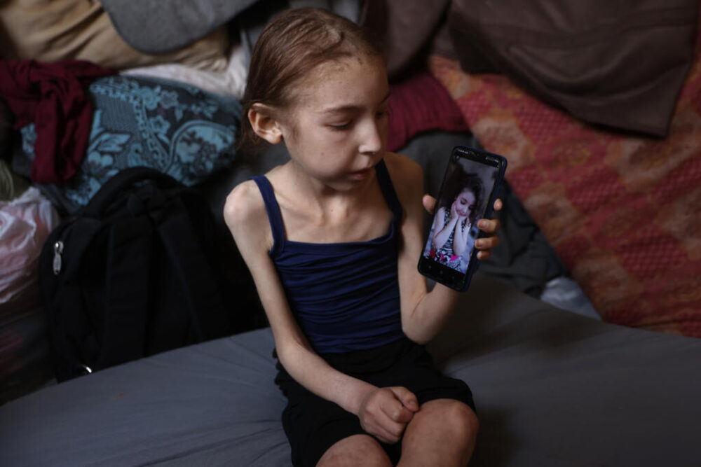 Rahaf Ayad, una niña palestina de 12 años que sufre de desnutrición, muestra en la pantalla de un móvil una antigua fotografía suya, el 4 de mayo de 2025 en una escuela convertida en albergue del centro de la ciudad de Gaza
