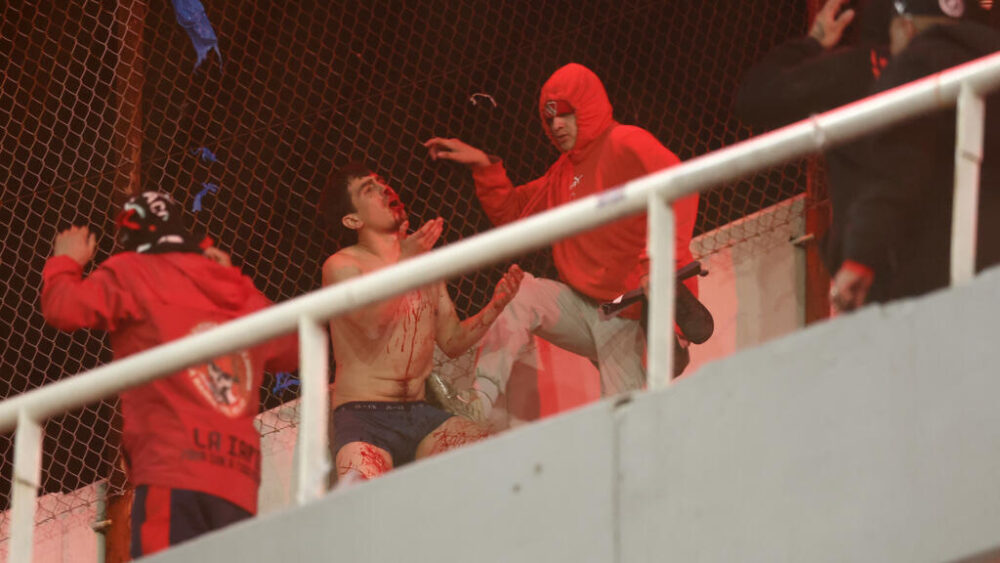 Un aficionado de la Universidad de Chile sangra tras ser golpeado por hinchas de Independiente durante una pelea en el estadio Libertadores de América de Avellaneda, provincia de Buenos Aires (Argentina), el 20 de agosto de 2025, en el marco del partido de vuelta de octavos de final de la Copa Sudamericana
