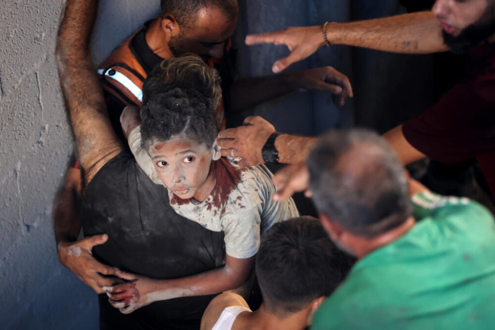 Palestinos transportan un niño herido tras un bombardeo israelí en Ciudad de Gaza el 30 de agosto de 2025