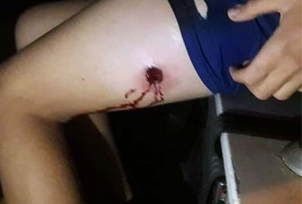 Un menor se disparó al festejar el triunfo de Bolivia, ocurrió en Bermejo 