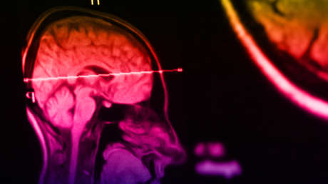 Ondas sonoras: la técnica que podría ayudar en el tratamiento de graves enfermedades