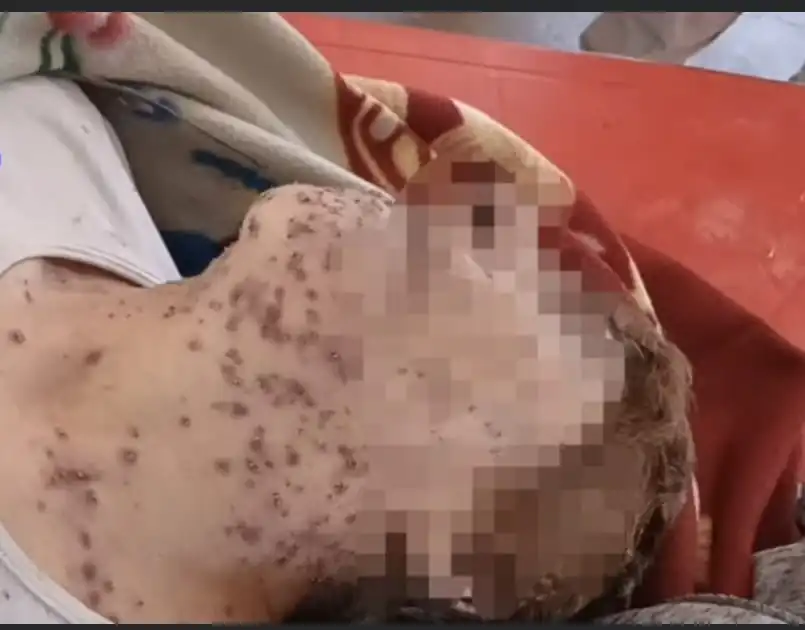 Una mujer de la tercera edad falleció tras ser atacada por un enjambre de abejas. FOTO: Captura