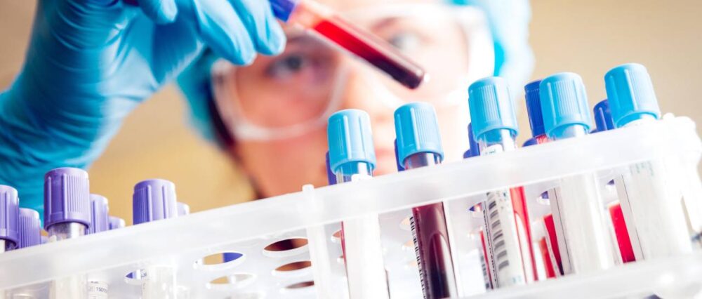 $output.data $output.data