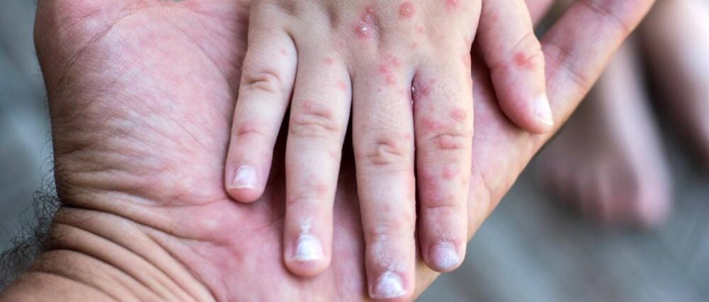 $output.data $output.data